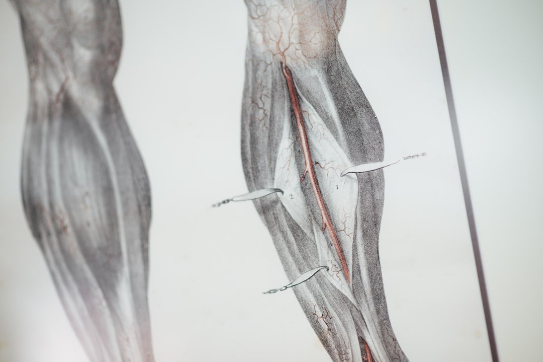 tendinite gluteo medio - Guida completa Ri-Hub teleriabilitazione