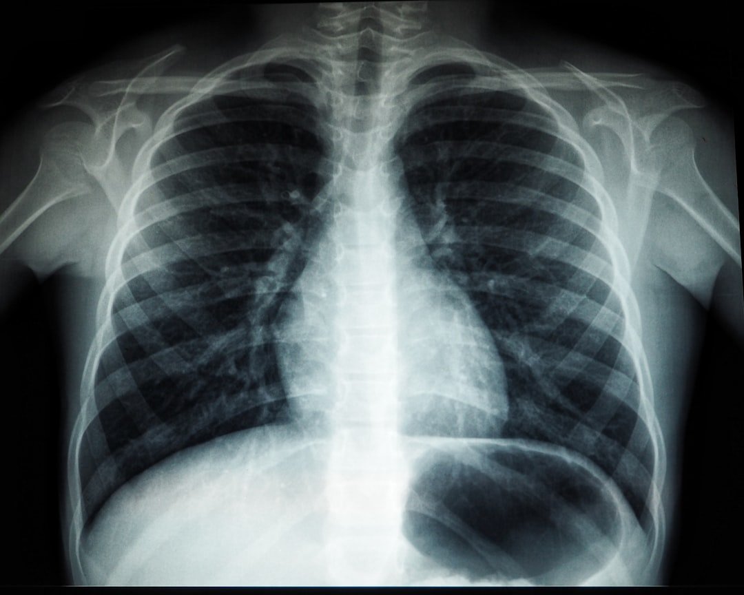 Fisioterapia per riabilitazione respiratoria | Ri-Hub