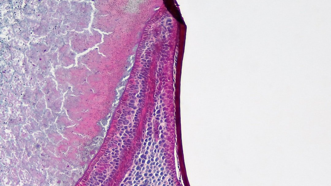 esercizi sternocleidomastoideo - Esercizi e rimedi | Ri-Hub