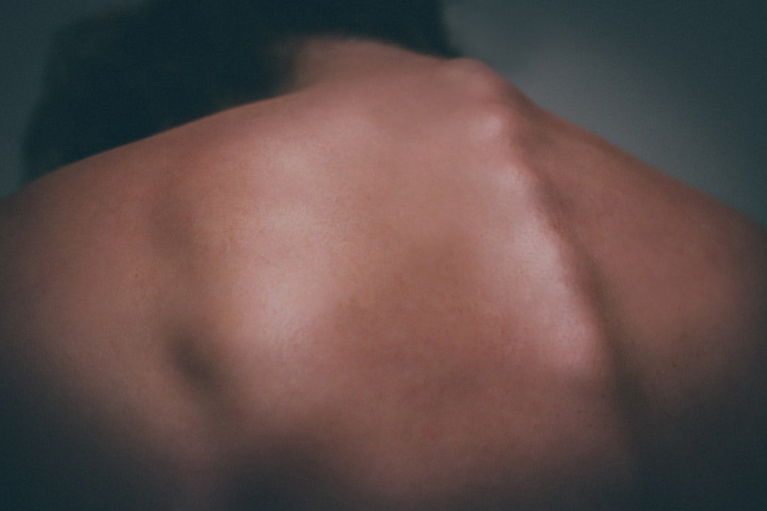 contrattura trapezio - Guida completa Ri-Hub teleriabilitazione