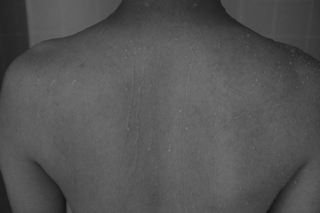 contrattura trapezio - Esercizi e rimedi | Ri-Hub